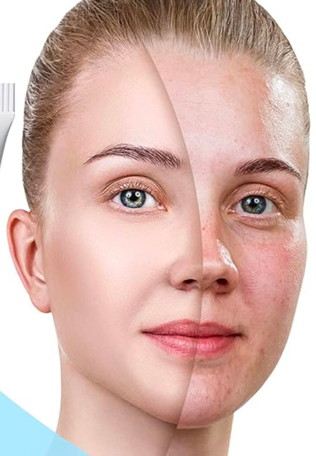 مبيضات البشرة