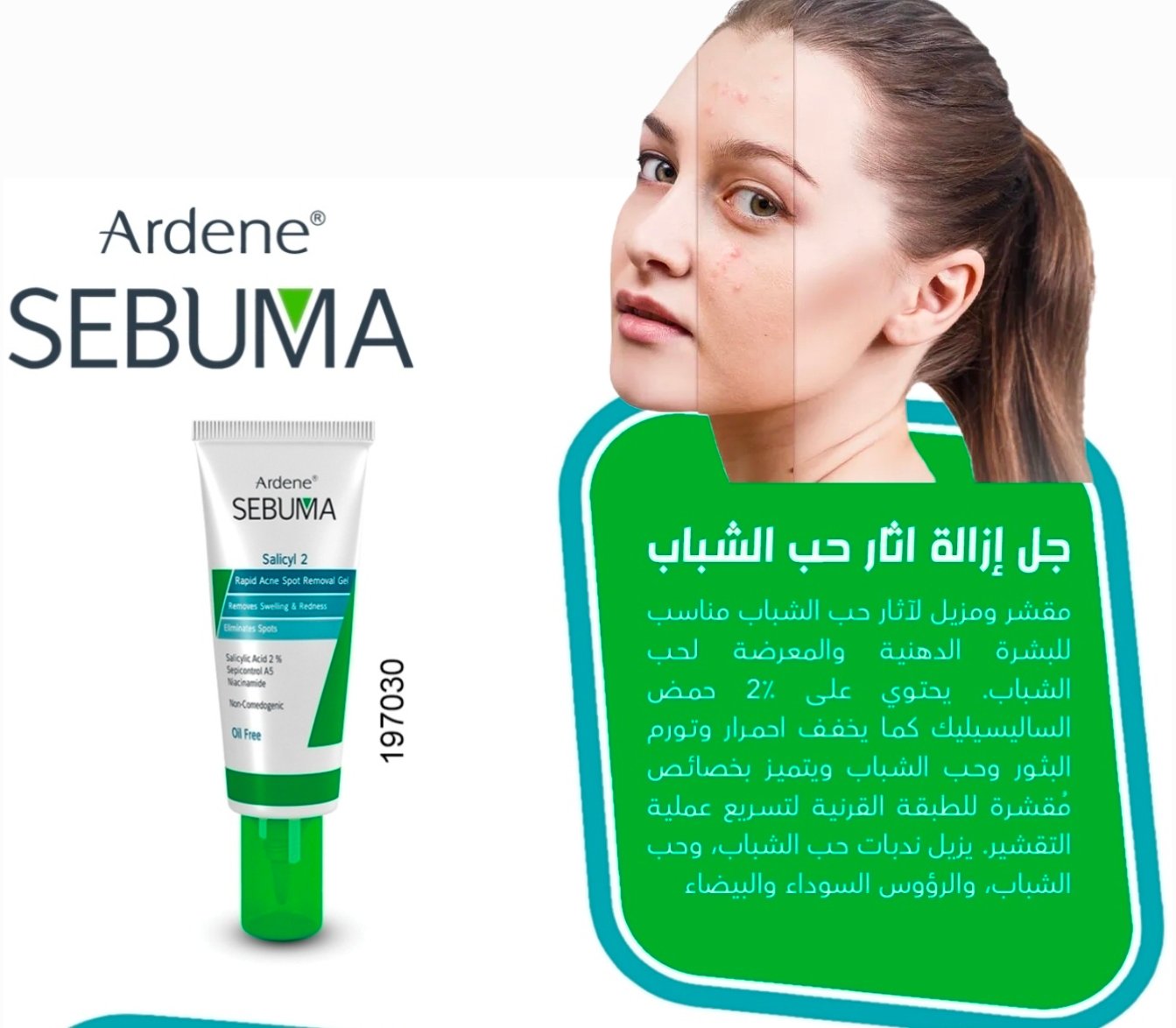 اردن سيبوما سالسيل ٢ لعلاج اثار حب الشباب 030
